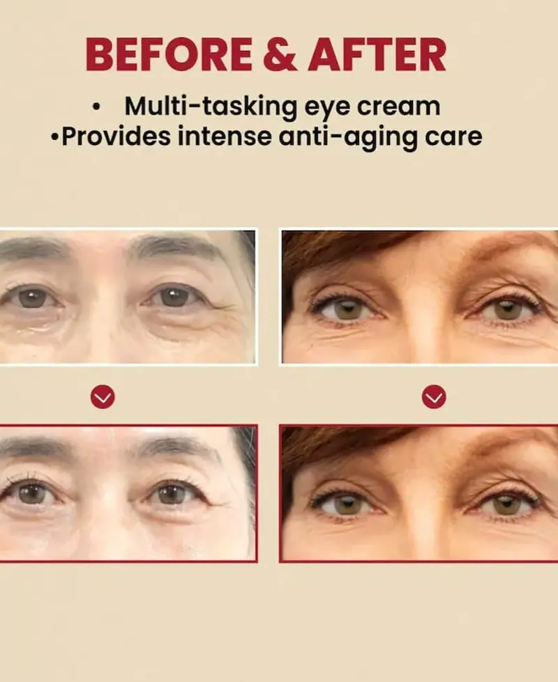 KSECRET SEOUL 1988 Eye Cream : Retinal Liposome 4% + Fermented Bean, wrinkle care, anti-aging, skin elasticity, pigmentation, brightening, retinol, 30ml/1.01 fl.oz. - Master